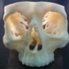 Cranium produced on a Stratasys Objet30 Pro 3D Printer, used to validate patient surgery prior to the operation