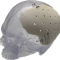 3D print implants in PEEK with 3D Systems